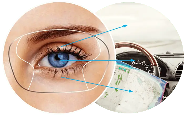 multifocal.png